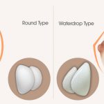 Breast Implant In Delhi | Types of Breast Implants | Cost of Breast Implants