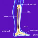 Types of Fibula Fractures and Symptoms in Ankle Injuries