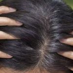 Hair turning grey? Try these five natural home remedies