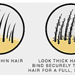 Struggling with Thinning Hair? Know the Real Reason with best Treatment