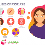 https://ayurvedatreatmentweb.wordpress.com/2019/12/21/psoriasis-treatment-in-ayurveda-panchkarma-by-dr-chanchal-sharma/