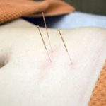 Would acupuncture be able to Be A Way Out Of Smoking