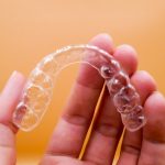 How Long Does Invisalign Take? | East Valley Dental Professionals