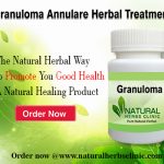 Natural Remedies for Granuloma Annulare Treat Itchy Skin