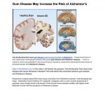 Gum Disease May Increase the Risk of Alzheimer’s by tooththisold600