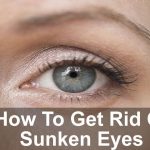 Sunken Eyes – How To Get Rid Of Sunken Eyes