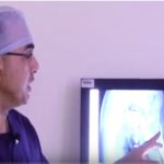 Total Knee Replacement Doctor in Jaipur – Dr Anoop Jhurani