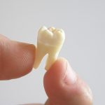 Tooth Extractions in Mesa, Arizona | East Valley Dental Professionals