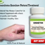 Natural Remedies for Granuloma Annulare Teat with Ginger and Green Tea