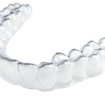 Best retainers teeth treatment service in Fort Washington