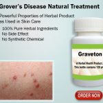 Natural Remedies for Grover’s Disease Causes and Treatment