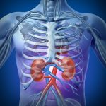Kidney Stones | Kidney Stone Center
