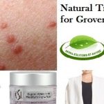 7 Natural Remedies for Grover’s Disease Treat with Neem Leaves