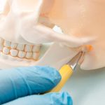 How To Treat TMJ Pain | East Valley Dental Professionals