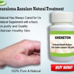 Top 7 Natural Remedies for Granuloma Annulare Treat Naturally