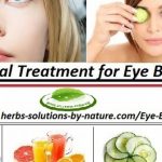 9 Natural Remedies for Eye Bags Best Cure for Puffy Eyes at Your Home
