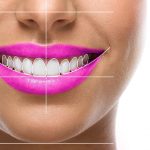 Hollywood Smile Design Best Cosmetic Dentist Hyderabad| Hollywood Smile Designing Cosmetic Dental Clinic Hyderabad
