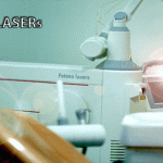 Laser Dental Clinic | Laser Dental Hospital| Laser Dentist in Secunderabad
