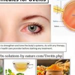 Natural Remedies for Uveitis with Precautions and Lifestyle Changes