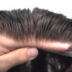 Easy hair loss solutions for men Toronto
