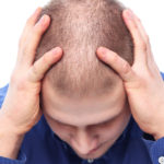 Does Masturbation Cause Hair Loss?
