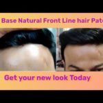 Hair Patch price In Delhi | Hair Bonding | Men Hair Patch | Men Wigs | Wigs For Men | 9891569519