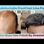 Hair Wigs in Delhi | Hair Wig Shop In Delhi | Best hair Patch In Delhi | 9891569519