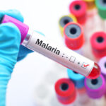 How is malaria treated and prevented?