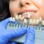 Best Dental Clinic for Teeth Whitening