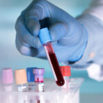 Things you should know about Blood Testing
