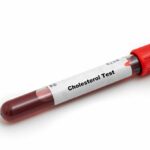 Protect Your Heart in the Summer: Understanding the Value of Cholesterol Testing – Intrigue