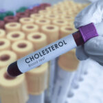 Understanding the Importance of Regular Cholesterol Testing
