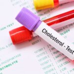 Who Should Get Cholesterol Tested?