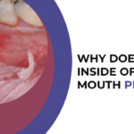 Why does the skin inside of your mouth peel?