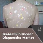 AI-Powered Tools make their Mark in Skin Cancer Diagnostics Market