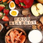 Can Allergy Testing In Northampton Detect Food Allergies?