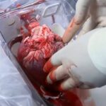 heart transplant surgery cost in india