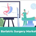 Bariatric Surgery Market: Latest Technological Innovations